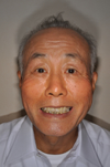 K.K.さん(男性・70才)