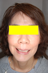 Y.O.さん(女性・57歳)