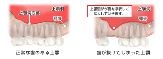上顎の比較