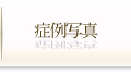 症例紹介